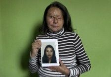Colombia: Los ataques con ácido a mujeres aumentan y las víctimas están desprotegidas
