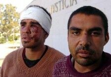 Córdoba: la marcha de la gorra y un ataque al corazón